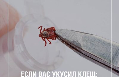 Что делать, если укусил клещ: пошаговая инструкция