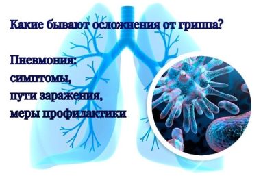 Осложнения гриппа: пневмония — симптомы, пути заражения, меры профилактики