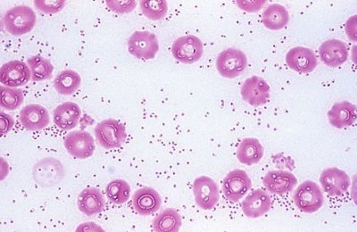 Угрозы для жизни и здоровья населения нет