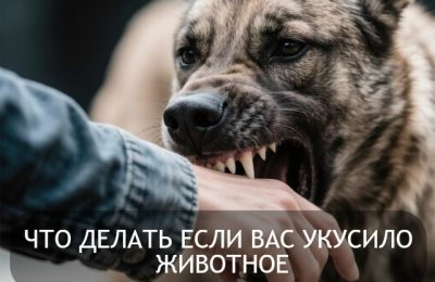 Что делать, если укусило животное?