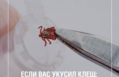Если укусил клещ: что делать?