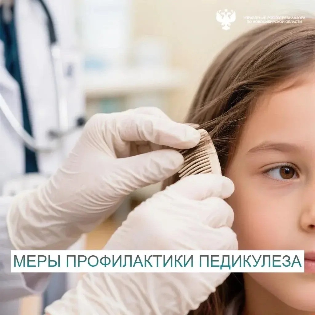 Педикулёз: правила профилактики