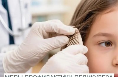 Педикулёз: правила профилактики